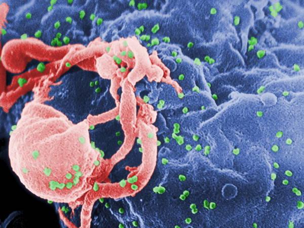 UN: Nearly 40 million had HIV in 2023, many died due to lack of treatment