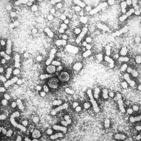 Targeting HBV with RNA Interference: Paths to Cure