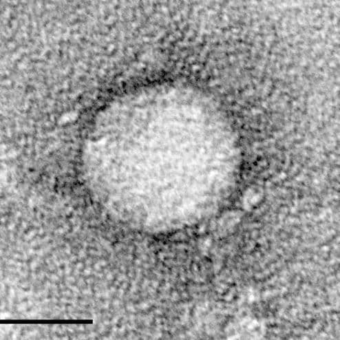 Sergas Treated Nearly 10,000 Patients with Hepatitis C in the Ten Years that the Plan for Elimination in SNS Is in Place.