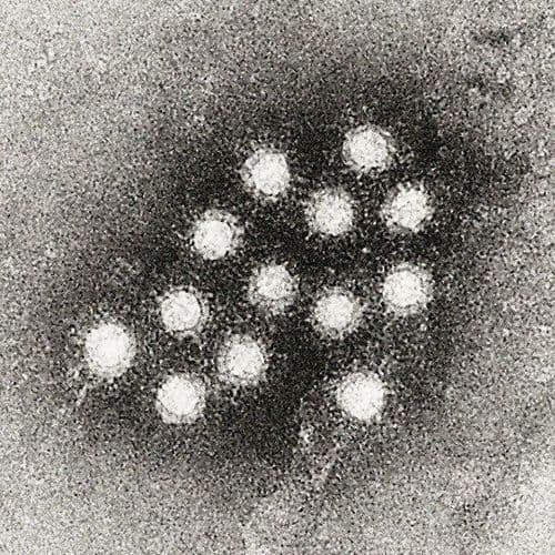 Hepatitis A outbreak in several European countries