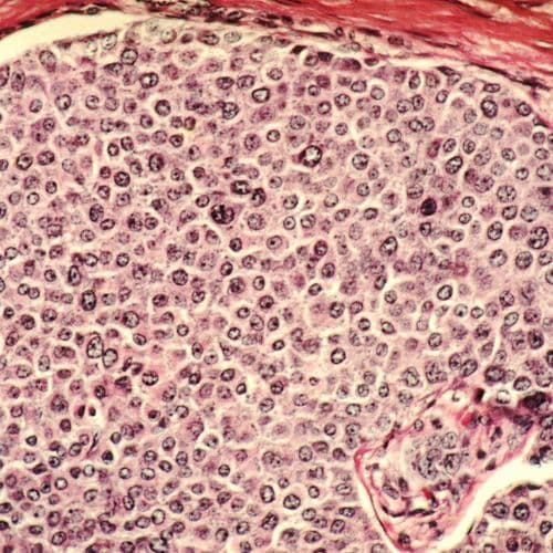 The Most Important Tips for Successfully Dating a Cancer