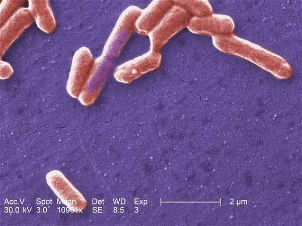A look at E. coli 0157 outbreaks in Canada