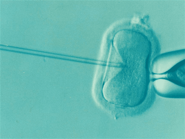 Second Alabama provider pauses IVF treatments after embryo ruling