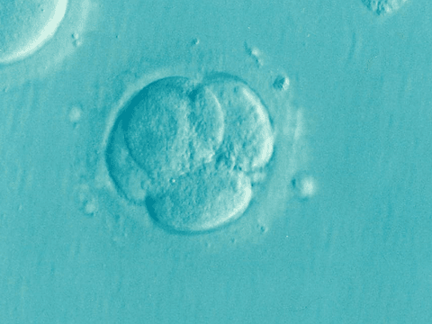 What’s next after the Alabama ruling that counts IVF embryos as children?