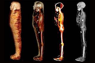 2,300-Year-Old 'Golden Boy' Mummy Digitally Unwrapped After a Century