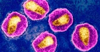 Experimental HIV vaccine regimen safe but ineffective, NIH study finds